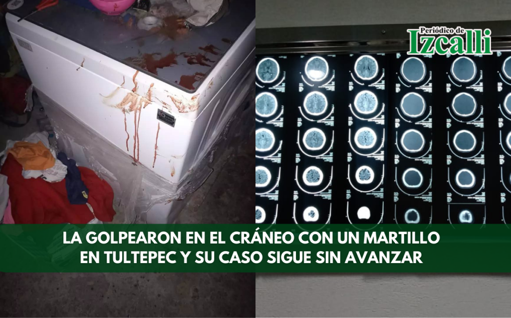 La golpearon en el cráneo con un martillo en Tultepec y su caso sigue sin avanzar